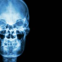 The X-Ray 