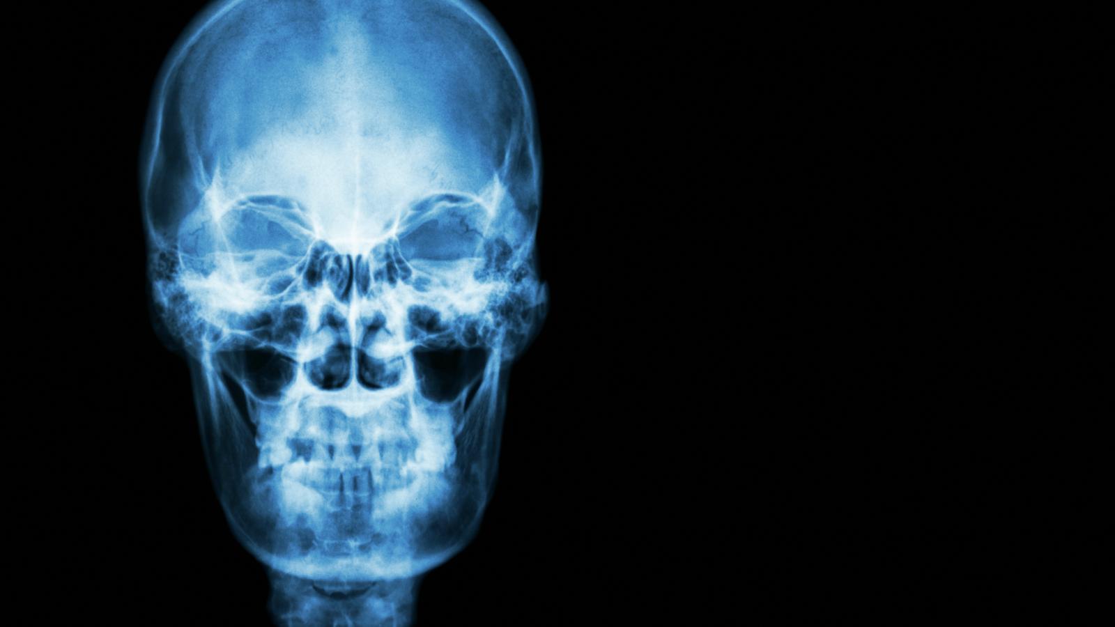 The X-Ray 